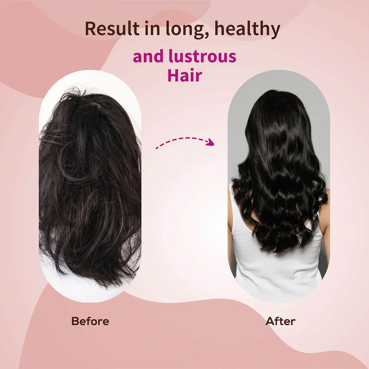 Ayouthveda Anti-Hair Fall Shampoo with Onion and Coffee - 200ml